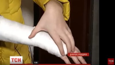 Жительці Нікополя інспектор газової служби зламала руку (Відео ТСН)
